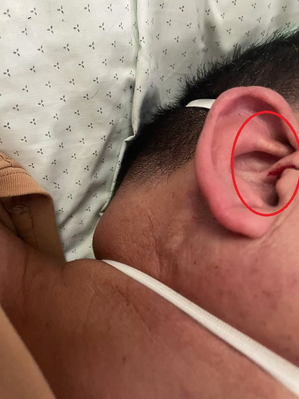 �������ҽԺ����ʱ�Ĳ�����Ƭ�������ϸ��������������Ѫ